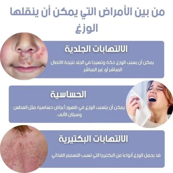 مبيد الوزغ الاصلي 2024