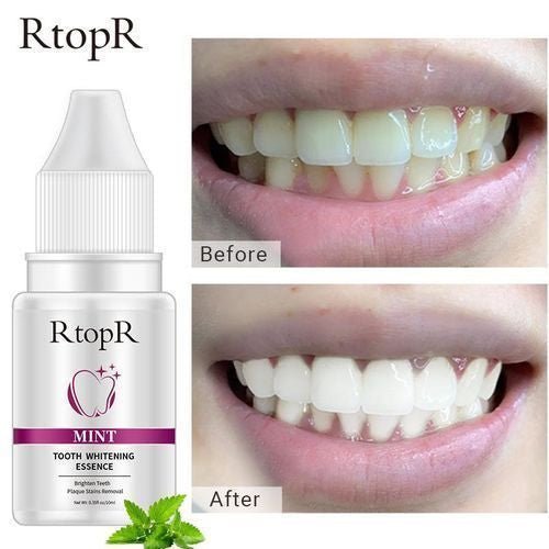 مبيض الأسنان الأكثر طلبا، من RtopR - Makfool